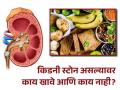 किडनी स्टोन असल्यावर काय खावे-प्यावे किंवा काय खाणं टाळावे? - Marathi News | What to eat or not in kidney stone? you should know | Latest health News at Lokmat.com