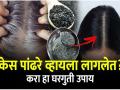 कपाळावरचेच केस जास्त पांढरे झालेत? डाय-कलर न लावता काळ्याभोर केसांसाठी करा ३ उपाय - Marathi News | Simple Ways to Dye Hair Black Naturally : 3 Natural Ways to Color Your Hair without Chemicals | Latest sakhi News at Lokmat.com
