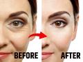 Skin Care Tips : त्वचा सैल पडू नये, ओघळू नये म्हणून करा ५ सोपे उपाय - Marathi News | Skin Care Tips: 5 Easy Remedies To Prevent Loose Skin | Latest sakhi News at Lokmat.com