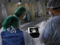 Coronavirus: कोरोना व्हायरसच्या लक्षणांचा क्रम संशोधकांनी शोधला; डॉक्टरांना मिळणार मोठी मदत - Marathi News | Coronavirus: Scientists decode how Covid-19 begins to appear in humans | Latest health Photos at Lokmat.com