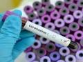 CoronaVirus in Washim : मृतक ‘क्लीनर’च्या संपर्कातील ‘ड्रायव्हर’ही पॉझिटीव्ह - Marathi News | CoronaVirus in Washim: 'Driver' in contact with dead 'cleaner' is positive | Latest vashim News at Lokmat.com