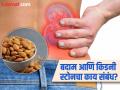 बदाम खाल्ल्यानं किडनी स्टोन होतो? जाणून घ्या एका दिवसात किती बदाम खाणं सुरक्षित! - Marathi News | Do Almonds Cause Kidney Stones? | Latest health News at Lokmat.com