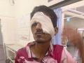 लोकल वर दगडफेकीत प्रवाशी मुलगा जखमी, डोळ्याला मार - Marathi News | Passenger boy injured in stone pelting on local, hit eye | Latest navi-mumbai News at Lokmat.com