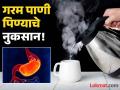 गरम किंवा कोमट पाणी पिण्याचे गंभीर नुकसान, दुर्लक्ष कराल तर डॉक्टरकडे जाण्याची येईल वेळ! - Marathi News | These people should avoid Lukewarm or hot water that damages body | Latest health Photos at Lokmat.com