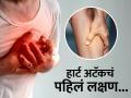 छातीत दुखण्याच्या खूप आधीच दिसतं Heart Attack चं हे लक्षण, दुर्लक्ष करणं पडू शकतं महागात - Marathi News | Body shows leg pain as first symptom of heart attack before chest pain dont ignore it | Latest health News at Lokmat.com