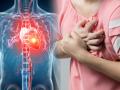 Heart Attack : ऐन तारुण्यात हार्ट अटॅक येण्याची ५ कारणं, जरा स्वत:वर प्रेम करा.. - Marathi News | How to Prevent From Heart Attack: Why Does A Heart Attack Occur At A Young Age? 5 important reasons, wake up on time, otherwise ... | Latest sakhi News at Lokmat.com
