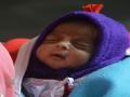 डॉक्टरांच्या प्रयत्नांमुळे केवळ ६५० ग्रॅम वजन असलेल्या चिमुकलीस मिळाले जीवदान - Marathi News | Doctor's efforts Gives Life to only 650 grams Weighed baby | Latest dharashiv News at Lokmat.com