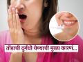 रोज दोनदा ब्रश करूनही तोंडाला दुर्गंधी येते? काही व्हिटामिन्सची कमतरता असू शकतं कारण... - Marathi News | These 5 vitamin deficiencies can be the reason behind bad breathe | Latest sakhi News at Lokmat.com
