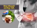 लिव्हर खराब करणारे हे पदार्थ खाणं कायमचं करा बंद, फक्त दारुनेच लिव्हर खराब होतं असं नाही.. - Marathi News | Liver Health : Which foods are most harmful for liver | Latest sakhi Photos at Lokmat.com