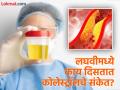 लघवीमध्ये दिसतात शरीरात बॅड कोलेस्ट्रॉल वाढल्याचे 'हे' ३ संकेत, दुर्लक्ष करणं पडेल महागात - Marathi News | These 3 signs in urine indicates high level of bad Cholesterol in the body | Latest health News at Lokmat.com
