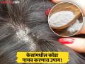केसांमध्ये चिकटून बसलेला कोंडा लगेच दूर करेल 'ही' पांढरी पावडर, केसगळतीही थांबेल! - Marathi News | How to use Baking soda to get rid off from dandruff | Latest beauty News at Lokmat.com