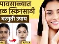पावसाळ्यात स्किन Dull झालीये? | How To Brighten Dull Skin Naturally | Dull Skin Treatment | - Marathi News | Dull skin in the rain? | How To Brighten Dull Skin Naturally | Dull Skin Treatment | | Latest health Videos at Lokmat.com