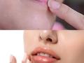 Beauty Tips: वरचा ओठ जास्त काळा पडलाय? हे घरगुती उपाय करा, काळपटपणा कमी होतो! - Marathi News | | Latest sakhi News at Lokmat.com