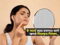 चेहर्‍यावर सतत पिंपल्स ? महागडे प्रॉडक्ट्स वापरुनही कमी होत नाहीत ? आहारातून कमी करा हे ५ पदार्थ .... - Marathi News | Pimples on your face? these 5 foods make it even worst , try home remedies | Latest sakhi News at Lokmat.com