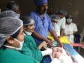 बीडमध्ये जन्मले दोन तोंड असलेले बाळ - Marathi News | Two-headed baby born in Beed | Latest beed Videos at Lokmat.com