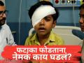Beed: फटाका विझलाय समजून पुन्हा पेटवायला गेला अन्...; बीडमध्ये सहा वर्षांच्या मुलासोबत भयंकर घडलं! - Marathi News | Diwali Tragedy: 6-Year-Old Boy Loses Sight in One Eye After Firecracker Explodes in His Hand in Beed | Latest maharashtra News at Lokmat.com