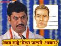 धनंजय मुंडे यांना बेल्स पाल्सीचं निदान, जाणून घ्या काय आहे हा आजार आणि याची लक्षणं! - Marathi News | Dhananjay Munde diagnosed with Bell's Palsy, know what this disease is and its symptoms! | Latest health News at Lokmat.com