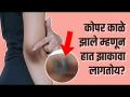 या घरगुती उपायांनी दूर करा कोपराचा काळेपणा | How to Lighten Dark Elbows | Black Elbow Removal - Marathi News | Get rid of dark elbows with these home remedies How to Lighten Dark Elbows | Black Elbow Removal | Latest health Videos at Lokmat.com