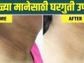 काळी मान उजळण्यासाठी घरगुती उपाय | How to Get Rid of Dark Neck | Dark Neck Treatment | Home Remedies - Marathi News | Home Remedies for Blackheads | How to Get Rid of Dark Neck | Dark Neck Treatment | Home Remedies | Latest beauty Videos at Lokmat.com