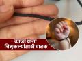 दृष्ट लागू नये म्हणून बाळाला काळा धागा बांधता? डॉक्टरांचा सल्ला, तो धागाच ठरतो धोकादायक कारण.. - Marathi News | Child specialist doctor tells black thread caused infection in baby | Latest sakhi News at Lokmat.com