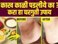 काळवंडलेल्या अंडरआर्म्ससाठी करा हा घरगुती उपाय | How to Get Rid of Dark Underarms | Dark Underarms - Marathi News | Do this home remedy for blackened underarms | How to Get Rid of Dark Underarms | Dark Underarms | Latest beauty Videos at Lokmat.com