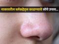 नाक, कपाळावर असलेले हट्टी ब्लॅकहेड्स सौंदर्य बिघडवतात? पाहा डॉक्टरांनी सांगितले काही उपाय - Marathi News | Doctor recommended 4 home remedies to get rid of blackheads | Latest sakhi News at Lokmat.com