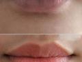 काळपट ओठ होतील गुलाबी! ४ घरगुती उपाय, ओठ कायम दिसतील सुंदर आणि राहतील मऊ - Marathi News | how to treat Dark lips will turn pink 4 home remedies lips skin care tips | Latest sakhi News at Lokmat.com
