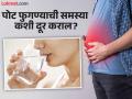 पोट फुगण्याची समस्या झटक्यात होईल दूर, न्यूट्रिशनिस्टने सांगितले काही सोपे उपाय! - Marathi News | Warm lemon water to reduce bloating | Latest health News at Lokmat.com