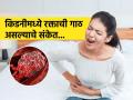 किडनीत रक्ताची गाठ झाल्यास दिसतात ‘ही’ लक्षणं, पाहा योग्य काळजी घेऊन कसं राहाल निरोगी - Marathi News | Symptoms of blood clotting in kidney, know causes and how to prevent it | Latest sakhi News at Lokmat.com