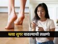 ब्लड शुगर हाय झाली की पायांवर दिसतात ‘ही’ लक्षणं, पाहा तुमच्या पायांवर दिसतात का या खुणा - Marathi News | Swelling pain burning or numbness indicate high blood sugar level | Latest sakhi News at Lokmat.com