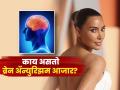 किम कार्दशियनला झाला मेंदूचा आजार, डॉक्टर म्हणतात, सर्वच महिलांना असतो धोका कारण.. - Marathi News | Model Kim Kardashian suffers from brain disease know details about it | Latest sakhi News at Lokmat.com