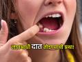 Jara Hatke: अजब प्रथा: 'या' गावात लग्नाआधी तोडले जातात वधूचे दात; पण का??? वाचा  - Marathi News | Jara Hatke: Strange custom: In 'this' village, the bride's teeth are broken before the wedding; but why??? Read | Latest jarahatke News at Lokmat.com