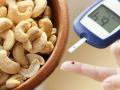 डायबिटीस असणाऱ्या व्यक्तींनी काजू खाणं फायदेशीर ठरतं का? - Marathi News | Benefits of eating cashew nuts in diabetes can a diabetic person eat cashew nuts | Latest food News at Lokmat.com