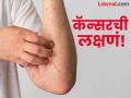 कॅन्सरची ७ सुरुवातीची लक्षणे ज्यांच्याकडे अजिबात दुर्लक्ष करू नका! - Marathi News | World Cancer Day 2025 : 7 Early Warning Signs of Cancer You Shouldn’t Ignore | Latest health News at Lokmat.com