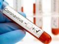 CoronaVirus : यवतमाळ जिल्ह्यात गेल्या 24 तासांत 429 जण कोरोना पॉझिटिव्ह, पाच जणांचा मृत्यू   - Marathi News | In Yavatmal district, 429 corona positive, five deaths in last 24 hours | Latest yavatmal News at Lokmat.com