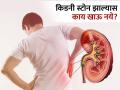 किडनी स्टोन झाला असेल तर चुकूनही खाऊ नका 'या' भाज्या, आणखी वाढेल तुमची समस्या! - Marathi News | Kidney stone diet foods to eat and avoid | Latest health News at Lokmat.com
