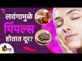 तुम्हाला लवंगाचे फायदे माहित आहे का? | Benefits of clove | How to Remove Pimples | Lokmat Sakhi - Marathi News | Do you know the benefits of cloves? | Benefits of clove | How to Remove Pimples | Lokmat Sakhi | Latest sakhi Videos at Lokmat.com