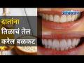 दातांना तिळाचं तेल कसे करेल बळकट? Ways to prevent tooth decay | Coconut Oil for dental hygiene - Marathi News | How can sesame oil strengthen teeth? Ways to prevent tooth decay | Coconut Oil for dental hygiene | Latest oxygen Videos at Lokmat.com
