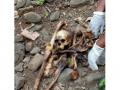 सोमलगड जंगलात सापडला मानवी हाडांचा सांगाडा - Marathi News | Skeleton found in Somalgad forest | Latest vardha News at Lokmat.com