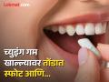 तोंडात च्युइंग गम टाकताच झाला मोठा स्फोट, विद्यार्थ्याचा वेदनादायी मृत्यू; जाणून घ्या कारण... - Marathi News | Ukraine student dies after chewing gum explosion | Latest jarahatke News at Lokmat.com