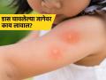 डास चावल्यामुळे अंगावर येणारी पुरळ - खाज कमी करण्यासाठी डॉक्टर सांगतात ‘हा’ उपाय - Marathi News | What to do if mosquitoes bite baby, doctor tells some tips | Latest sakhi News at Lokmat.com