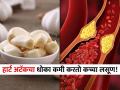कोलेस्टेरॉल कमी करण्यासाठी कसा प्रभावी ठरतो कच्चा लसूण? जाणून घ्या, खाण्याची योग्य पद्धत - Marathi News | Garlic can be beneficial in balancing cholesterol level in your body, Know the correct way to consume it! | Latest sakhi News at Lokmat.com