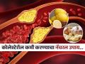 लसूण आणि लिंबाचा रस कोलेस्टेरॉल कमी करण्यासाठी ठरतो फायदेशीर, अभ्यासाचा दावा- टळतो हृदयरोगाचा धोका.. - Marathi News | Garlic and lemon juice reduce bad cholesterol naturally calim in research | Latest sakhi News at Lokmat.com