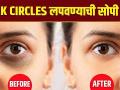 How to Hide Dark Circles with Makeup | How to Cover Dark Circles | Hide Dark Circles | - Marathi News | How to Hide Dark Circles with Makeup | How to Cover Dark Circles | Hide Dark Circles | | Latest beauty Videos at Lokmat.com