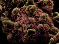CoronaVirus News: कोरोनाचं 'हे' रूप इतर Covid-19च्या रुपापेक्षा 10 पट घातक, देण्यात आलं असं नाव - Marathi News | CoronaVirus Marathi News coronavirus this mutation spread 10 times more infectious | Latest international Photos at Lokmat.com