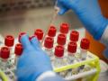 Coronavirus: राष्ट्रवादीच्या माजी आमदाराला कोरोनाची लागण; पत्नीचा रिपोर्टही पॉझिटिव्ह  - Marathi News | Coronavirus: Former NCP MLA infected with coronavirus; Wife's report is also positive | Latest maharashtra News at Lokmat.com