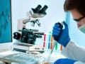 क्लाउड पॅथोलॉजी लॅबद्वारे ‘आरटीपीसीआर’चे रिपोर्टिंग! - Marathi News | Reporting of 'RTPCR' by Cloud Pathology Lab! | Latest akola News at Lokmat.com