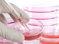 हृदयरोगावर स्टेम सेल थेरपी - Marathi News | Stem Cell Therapy in Heart Disease | Latest beauty News at Lokmat.com