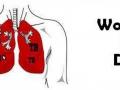 ​World Tuberculosis Day Special : भारतात दरवर्षी २० लाख व्यक्तींना नव्याने क्षयरोगाची लागण ! - Marathi News | World Tuberculosis Day Special: Every year 20 lakh people get infected with new tuberculosis! | Latest health News at Lokmat.com