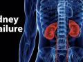 Health Alert : ​‘या’ कारणांनी होते किडनी फेल ! - Marathi News | Health Alert: 'These' causes kidney failure! | Latest health News at Lokmat.com